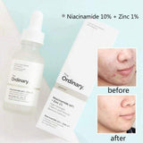 The Ordinary Niacinamide 10% + Zinc 1% Serum